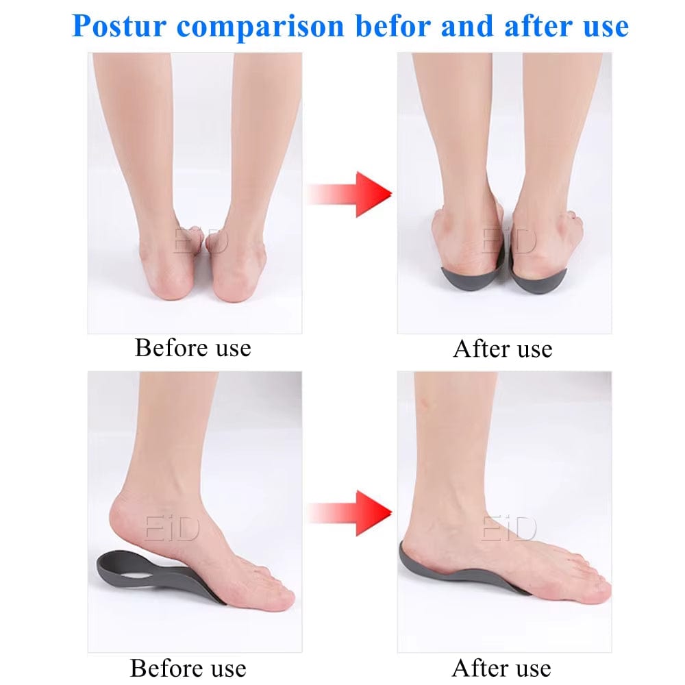 XO-Legs™ Orthopedic Insoles – Step Into Comfort, Say Goodbye to Foot Pain!